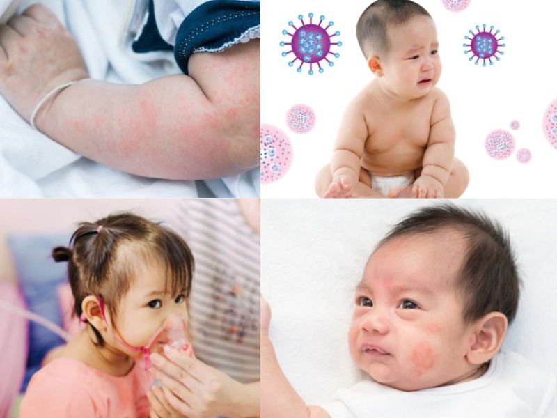 Các vấn đề da liễu phổ biến do tắm bằng nước máy ở trẻ em